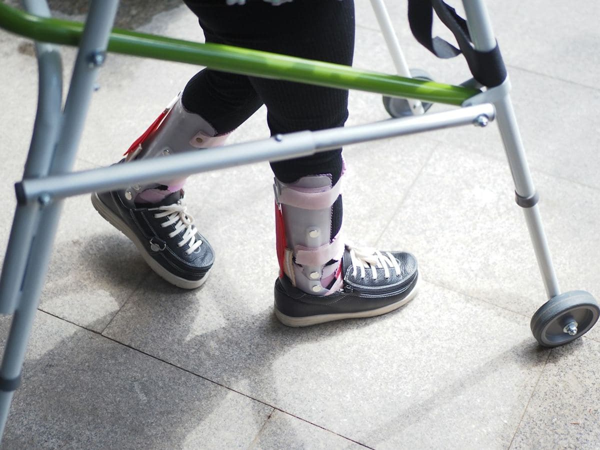 Paciente camina con andadera y férulas en los tobillos durante su rehabilitación